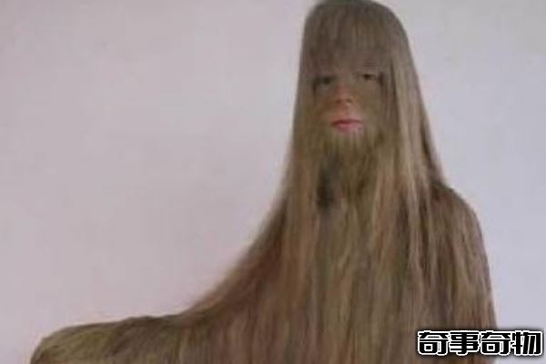 世界上体毛最长的人艾米丽 苏珊:毛发遮面似猿人